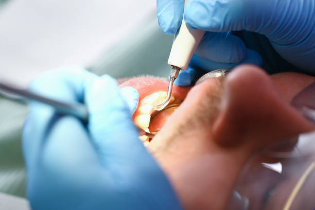 Best Emergency Dentist for Knocked-Out Tooth in Kodi Station, AK