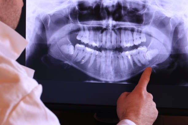 Best Emergency Root Canal Treatment in Kodi Station, AK